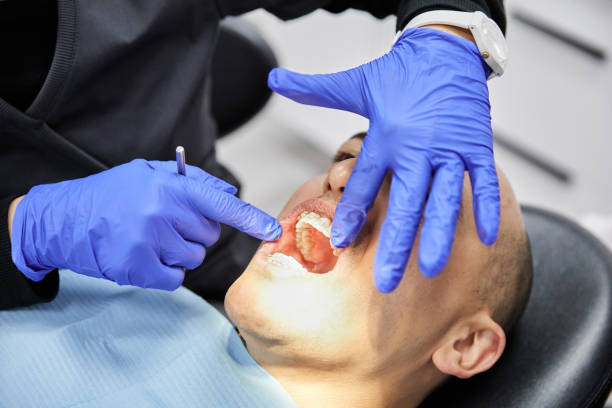 Best Emergency Dental Services for Seniors in Davidson, NC