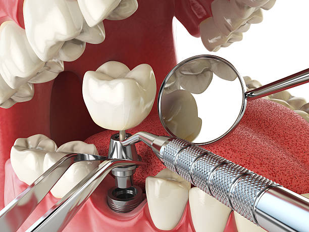 Best 24-Hour Emergency Dentist in Davidson, NC
